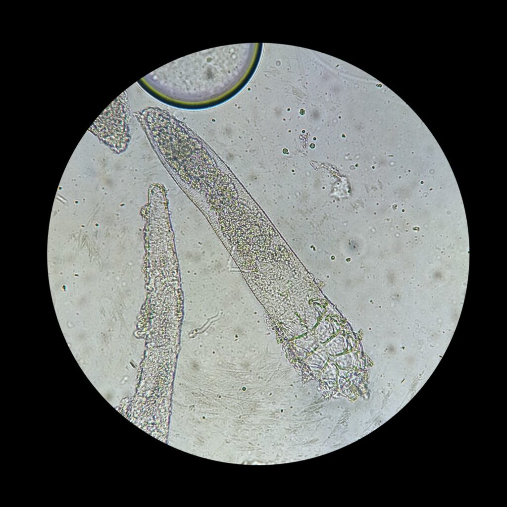 Demodex mites under a microscope