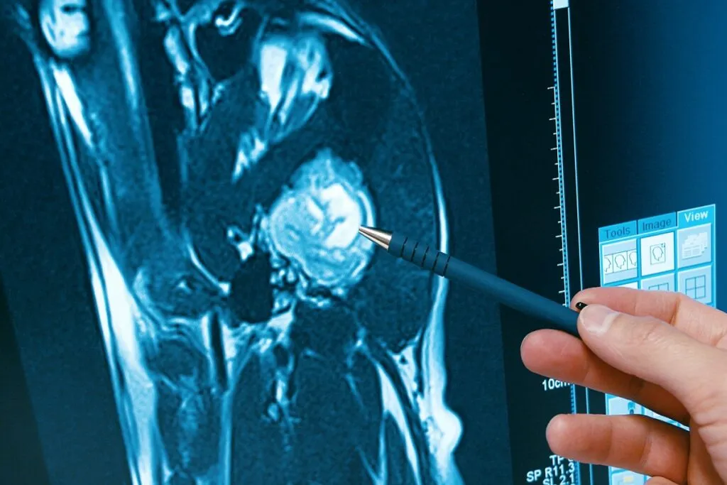 Veterinary CT scan being performed on a dog to detect a stroke.